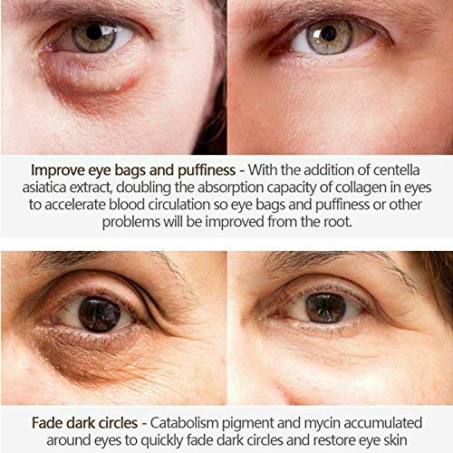 Magic Eye Cream, Instantly Remove Under Eye Bags Wrinkles Puffiness Dark Circles and Fine Lines, Anti Aging Eye Cream for Men Women-VeraVaultWomen