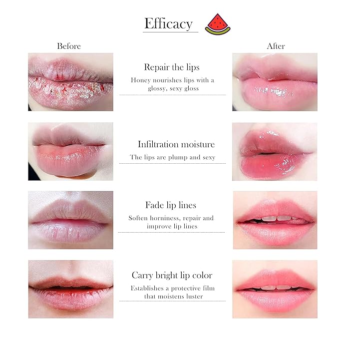1 PCS Bee Lip Balm Honey Pot, Moisturizing Watermelon Sleeping Lip Balm Lip Mask Overnight, Hydrate Lip Repair Prevent Dry and Cracked Lip Care, Nourishes the Lip Skin, Reduces Lip Lines-VeraVaultWomen