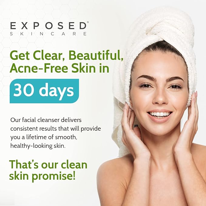 Exposed Skin Care Acne Facial Cleanser - Gentle Face Wash with Salicylic Acid for Acne Prone Skin - Pore Clarifying Acne Treatment for All Ages, Skin Types-VeraVaultWomen