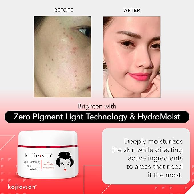 Kojie San Face & Body Complete Brightening Mini Set - 65 Gram x 2 Bars Soap, Body Lotion, Face Cream, and Facial Cleansing Brush-VeraVaultWomen