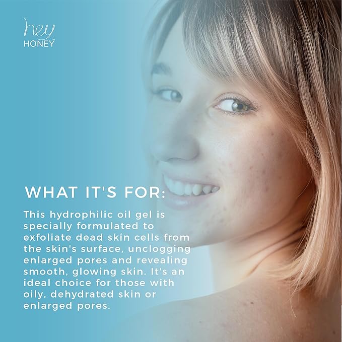 Hey Honey Skincare Be Clear - Acne Control Deep Pores Cleansing Gel | Propolis, Green Tea Oil, Camellia | Exfoliates, Unclogs Pores, Balances Oil Production | Fast Acting & Long Lasting | 2.7 Oz-VeraVaultWomen