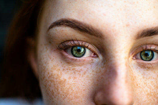 How to Fade Dark Spots and Hyperpigmentation Fast