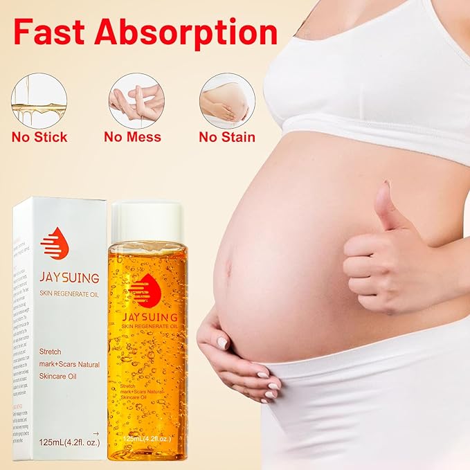 Stretch Mark Oil for Pregnancy, Skincare Body Oil for Scars and Stretchmarks, Pregnancy Oils for Stretch Marks Pre and Postpartum Natural Skincare Massage Oil, Skin Regenerate Oil, 4.2 fl.oz-VeraVaultWomen
