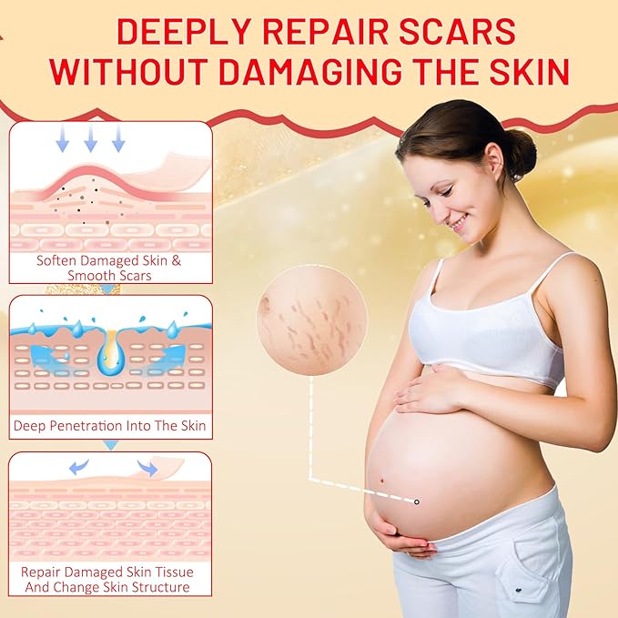 Stretch Mark Oil for Pregnancy, Skincare Body Oil for Scars and Stretchmarks, Pregnancy Oils for Stretch Marks Pre and Postpartum Natural Skincare Massage Oil, Skin Regenerate Oil, 4.2 fl.oz-VeraVaultWomen